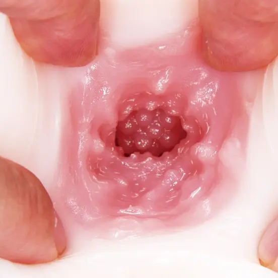 extreme_pleasure_hip_third_generation-4.webp